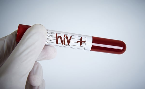 A gloved hand holds a vial of blood with "HIV+" written on the label